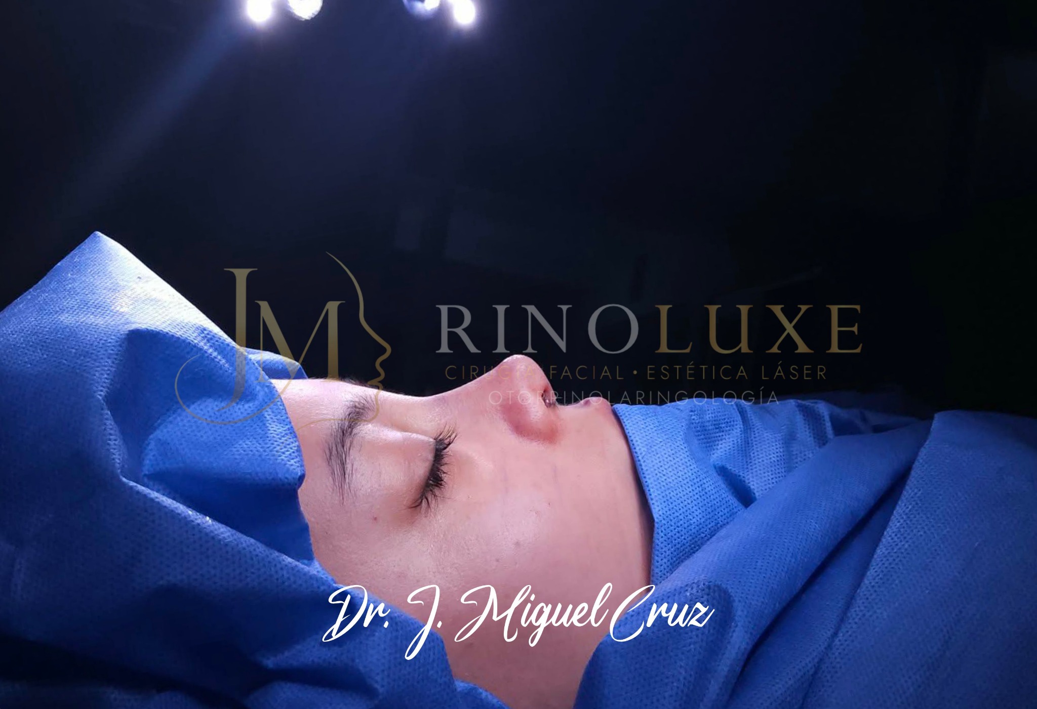 Fotografía clínica de rinoplastia 2
