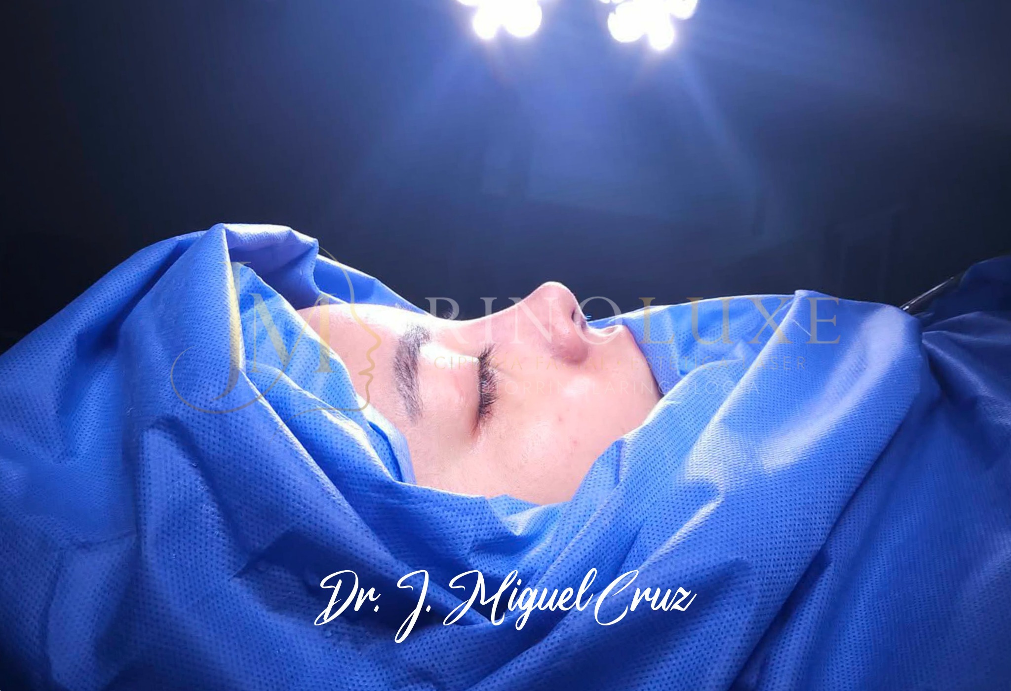 Fotografía clínica de rinoplastia 7