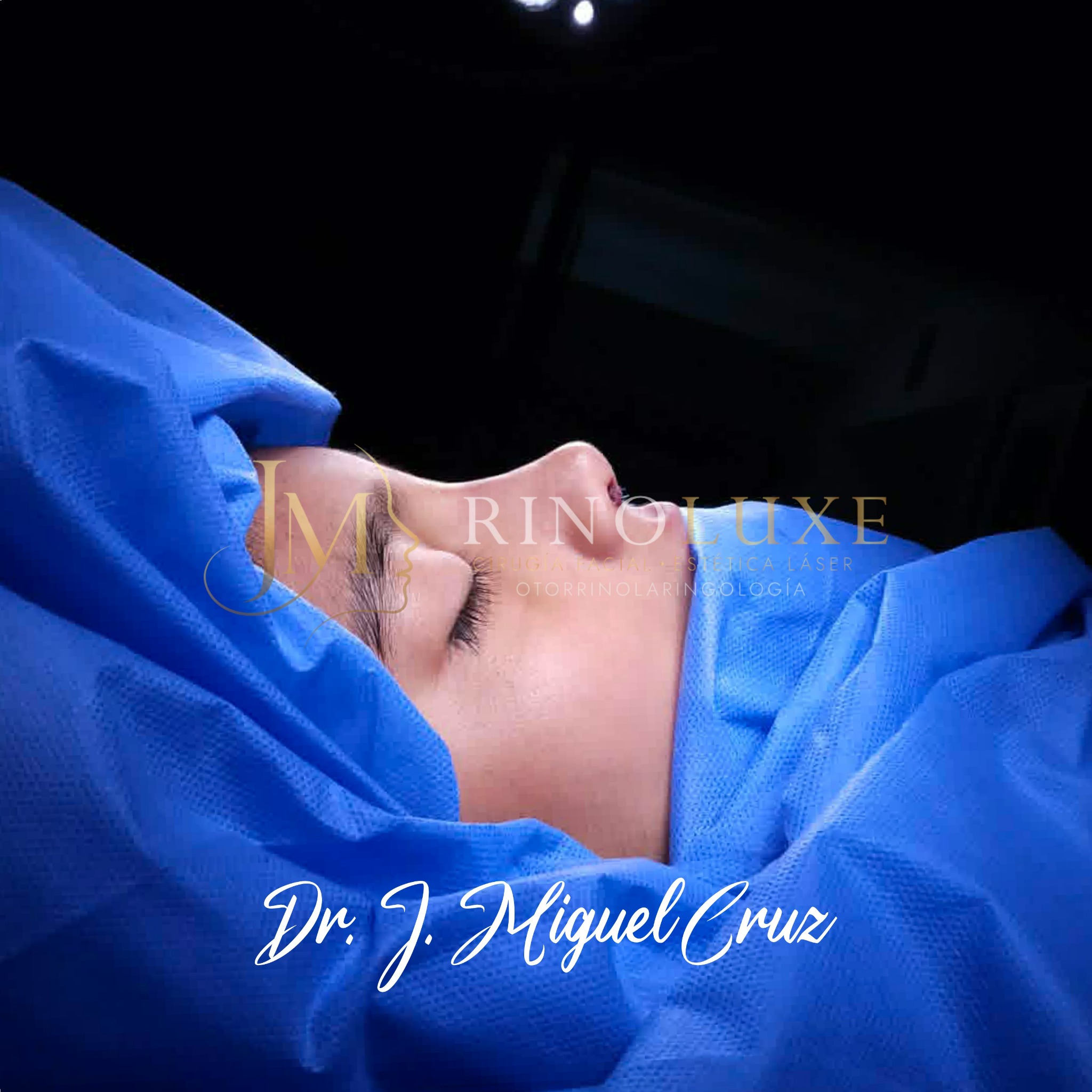Fotografía clínica de rinoplastia 5