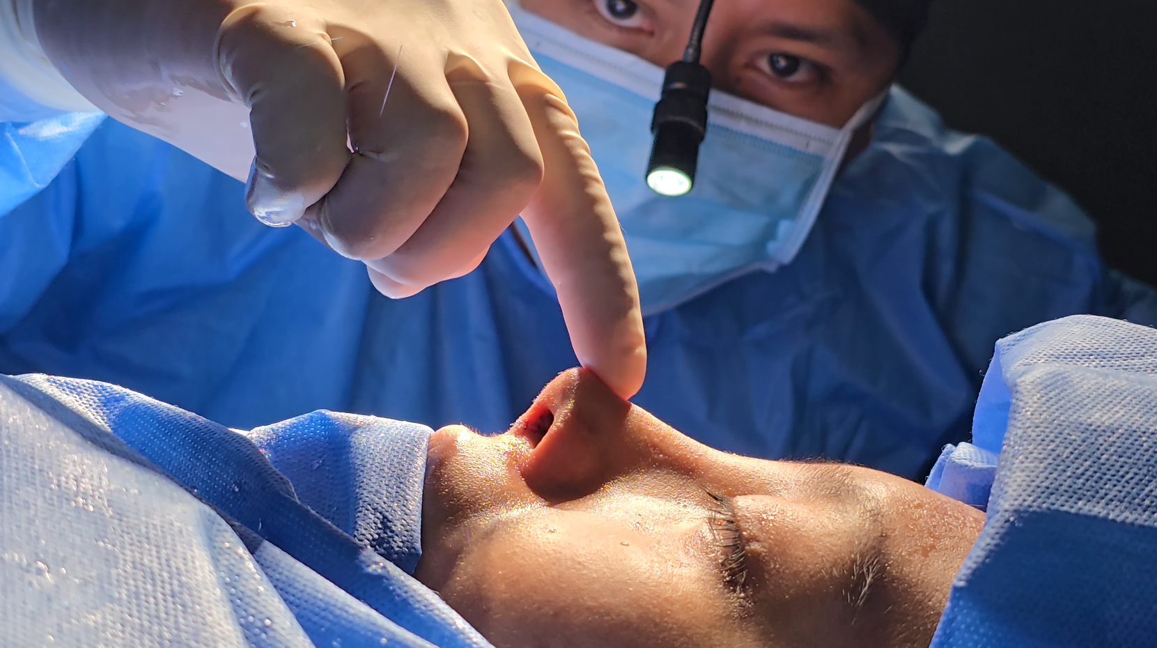 Dr. Juan Miguel Cruz Cartajena en procedimiento de rinoplastia
