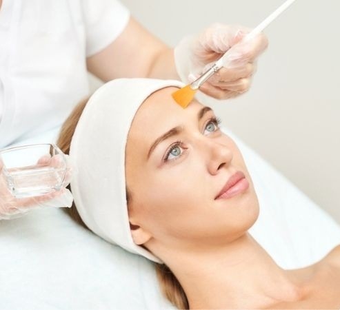 Peeling químico